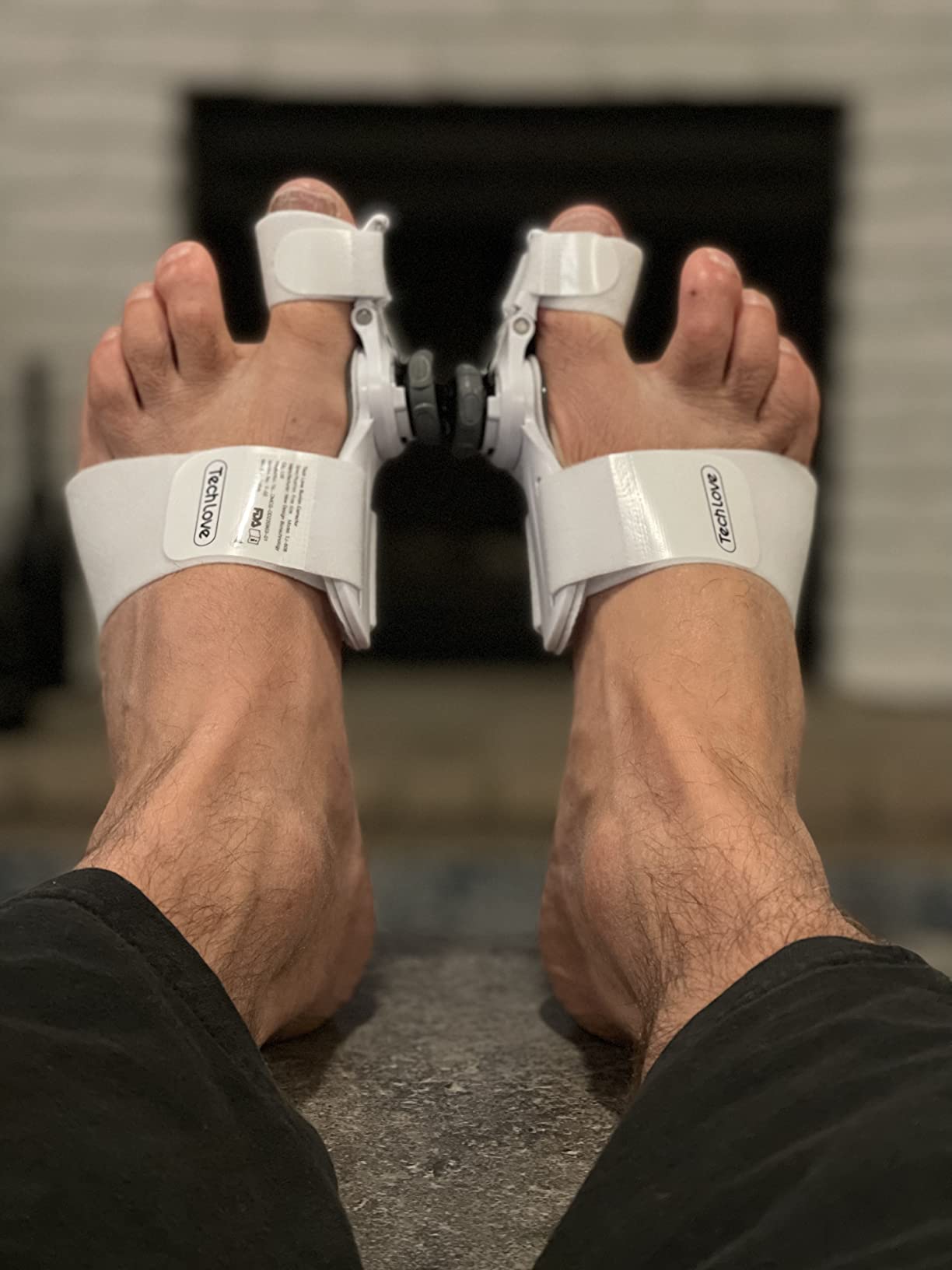 Bunion Splint Big Toe Corrector photo review