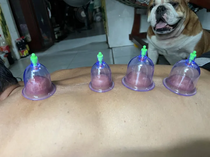 Cupping Therapy Set photo review