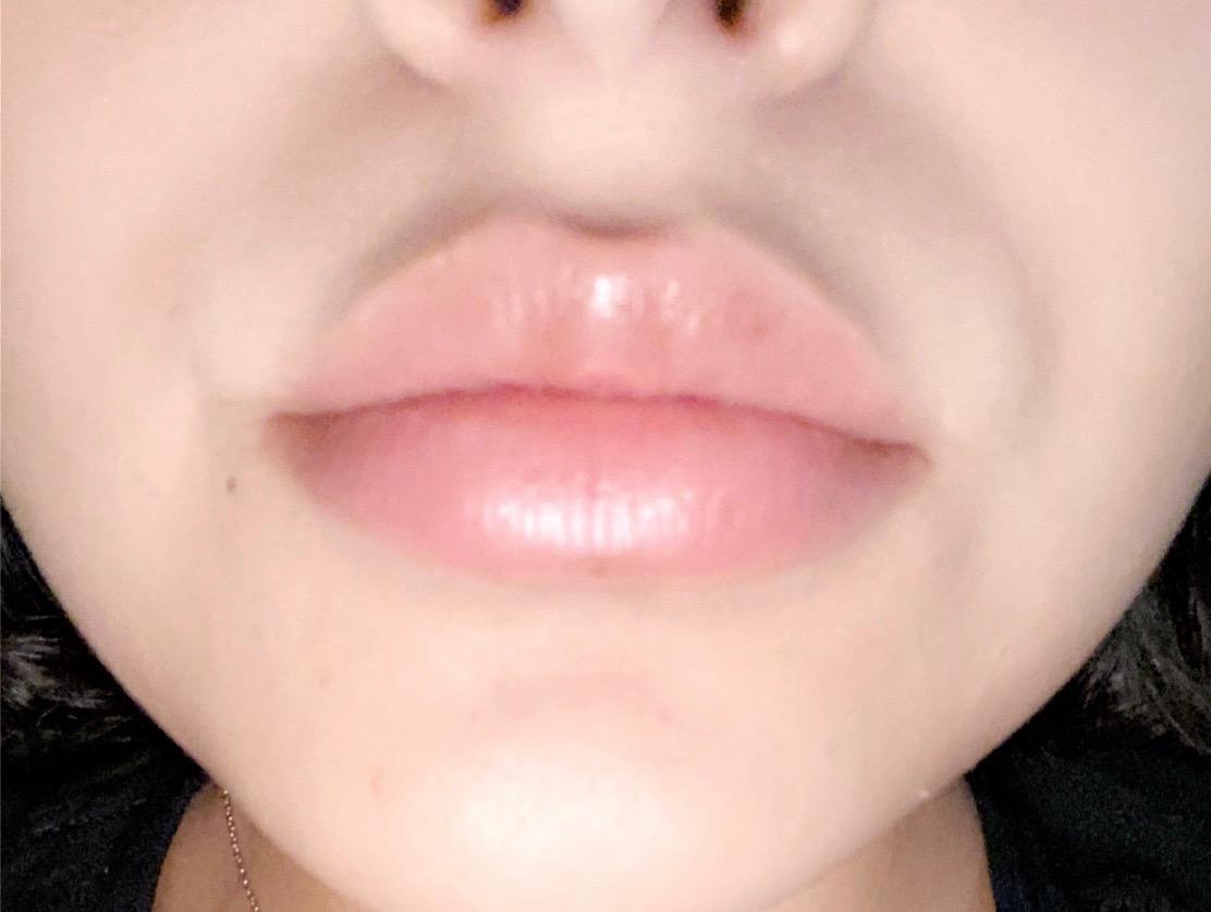 Electric Lip Plumper Device: Get Fuller Lips Naturally photo review