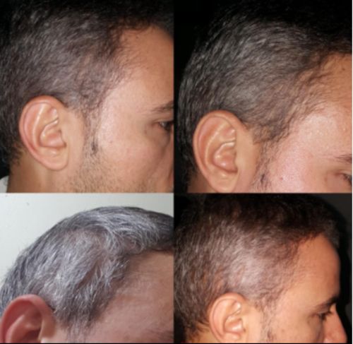 Grey Reverse Hair Color Shampoo photo review