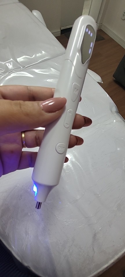 Home Laser Painless And Traceless Nevus Removal Artifact Blue Light Repair photo review