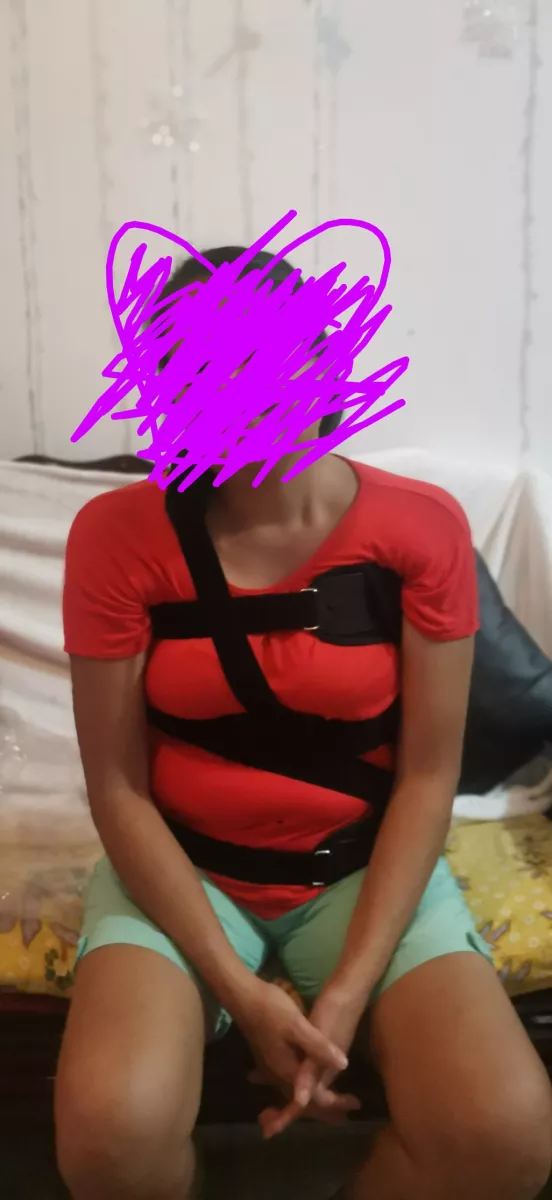 Scoliosis Brace for Correction and Treatment, Adjustable Spinal Orthosis photo review