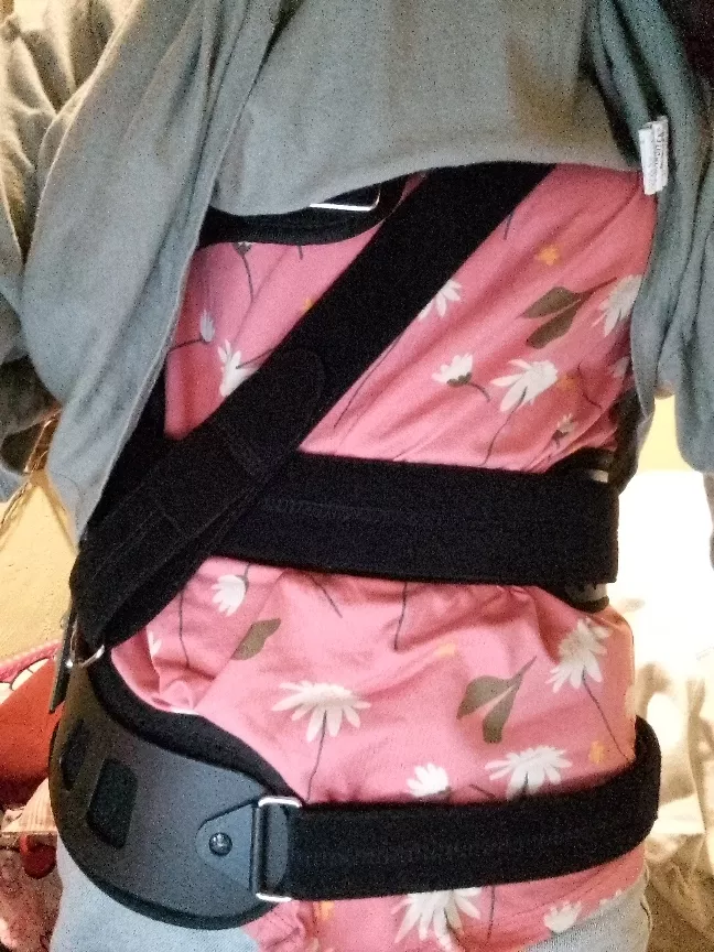 Scoliosis Brace for Correction and Treatment, Adjustable Spinal Orthosis photo review