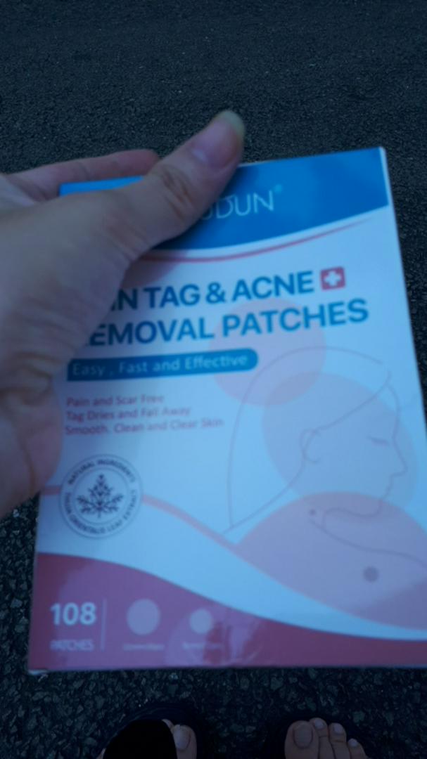 Skin Tag Removal Treatment Patch Convenient photo review