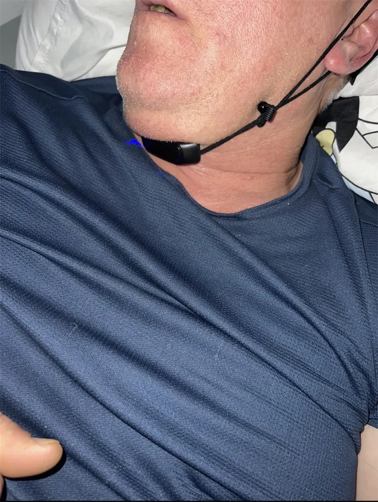 Smart Anti-Snoring Device With EMS Pulse photo review